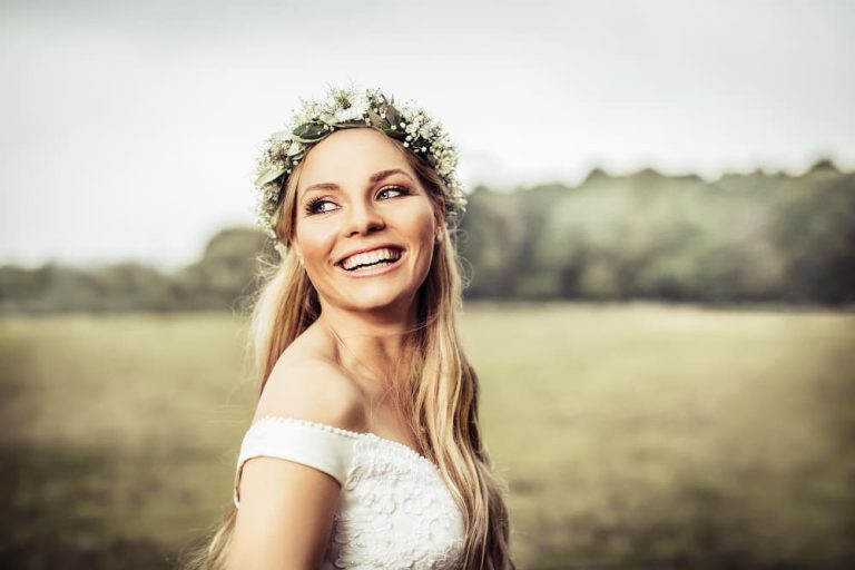 Estética dental para bodas.